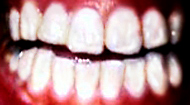 teeth02.jpg