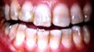 teeth01.jpg